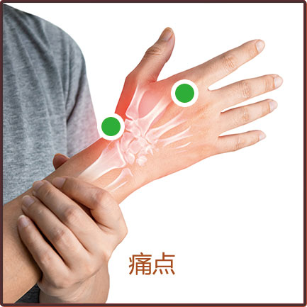 痛風/肌腱炎/腱鞘炎/腫脹等貼敷位置示意圖