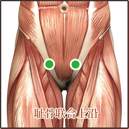 盆腔炎、尿道炎、宮頸炎、陰道炎等婦科疾病貼敷位置示意圖